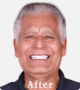 after a 3 on 6 treatment