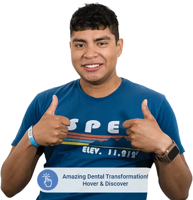 after to amazing dental transformation by dentistry cabo