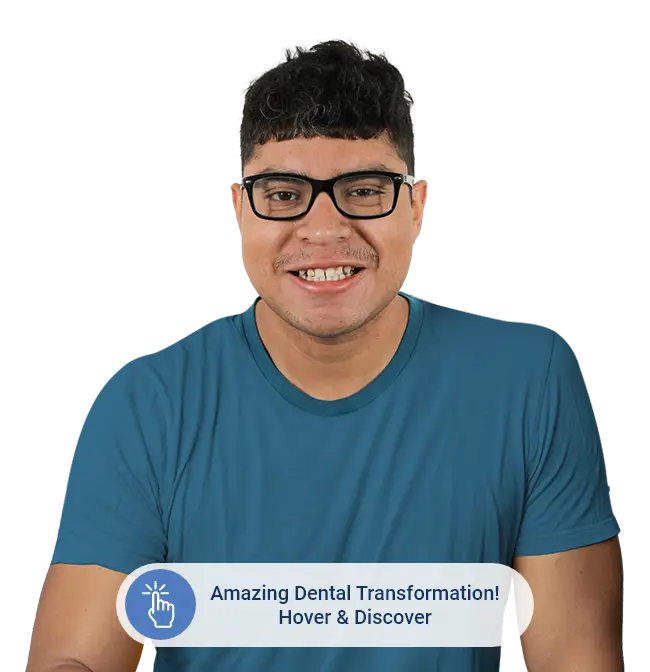 before to amazing dental transformation by dentistry cabo