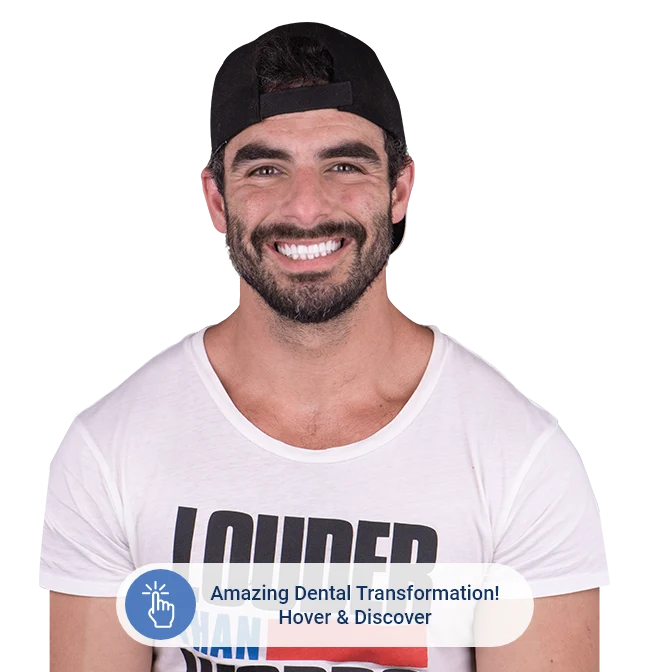 before to amazing dental transformation by dentistry cabo